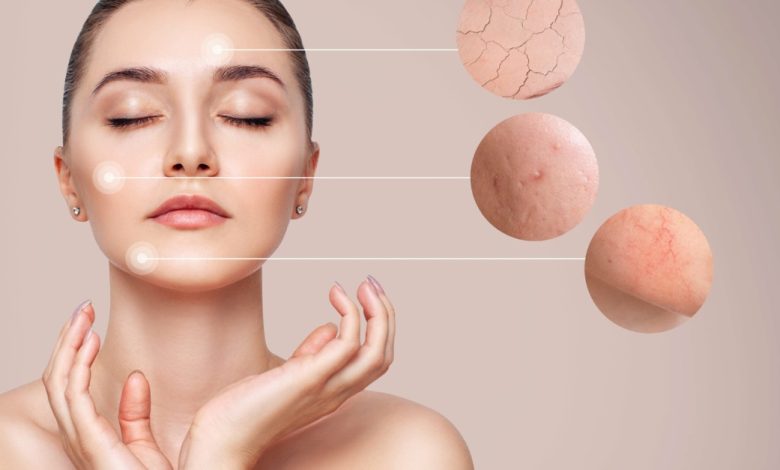 Unveiling the Future of Flawless Skin: Cutting-Edge Dermatology Techniques for Acne Treatment